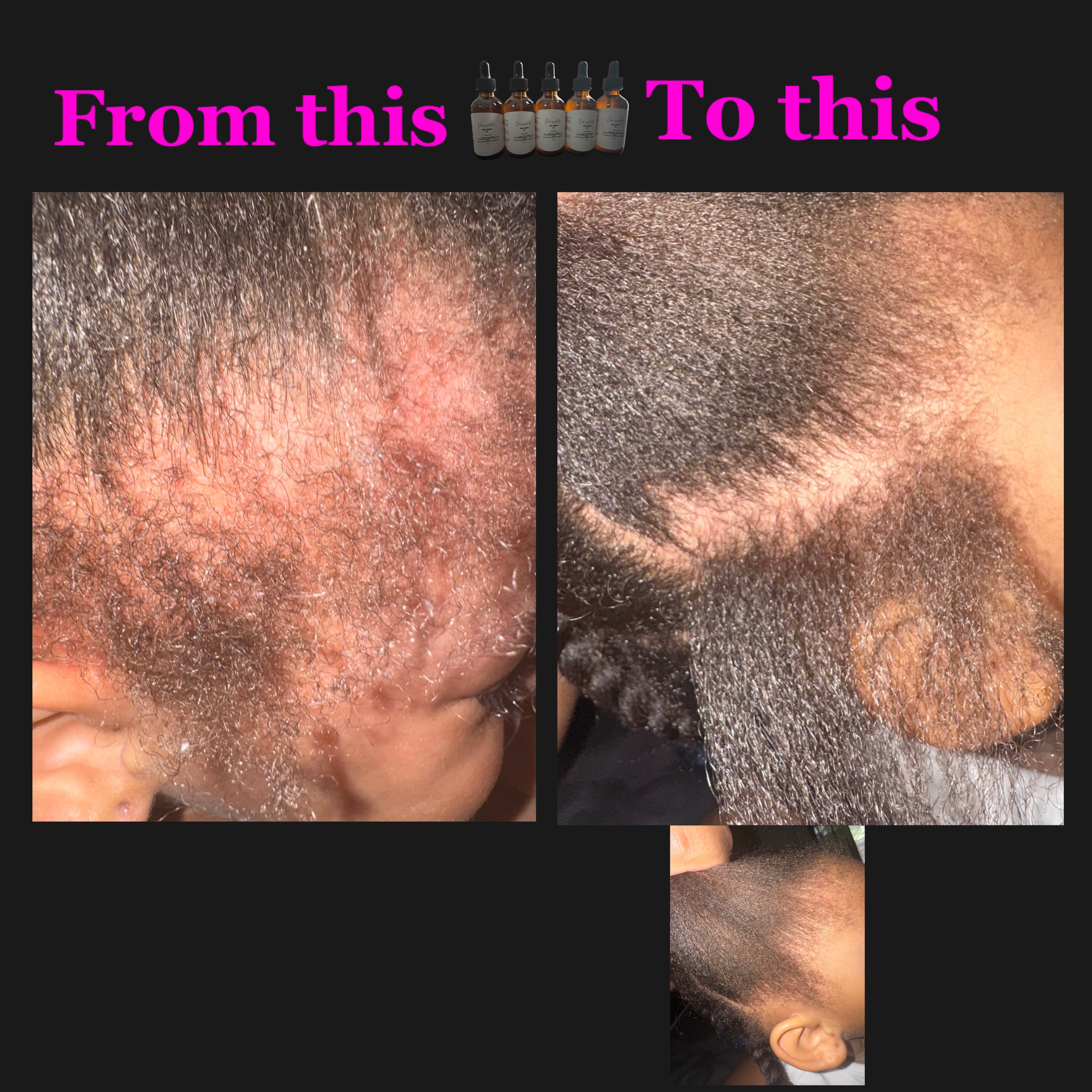 DCR ESSENTIALS hair growth oil